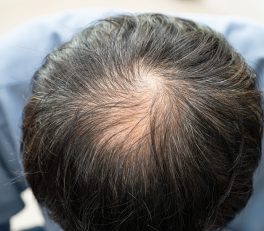 Soins capillaires et dentaires : les nouvelles tendances en esthétique médicale