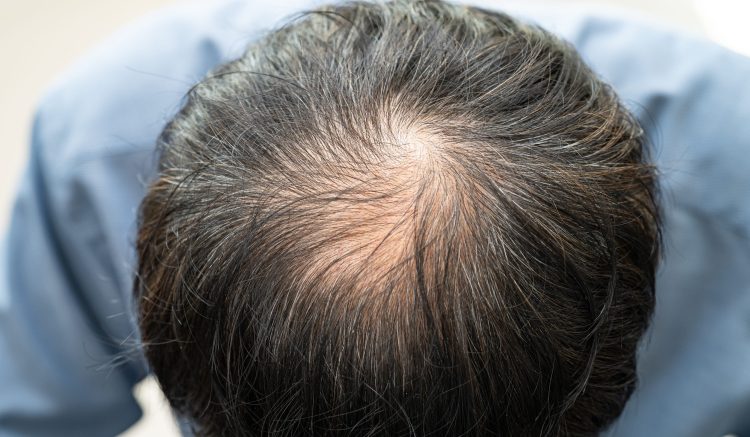 Soins capillaires et dentaires : les nouvelles tendances en esthétique médicale